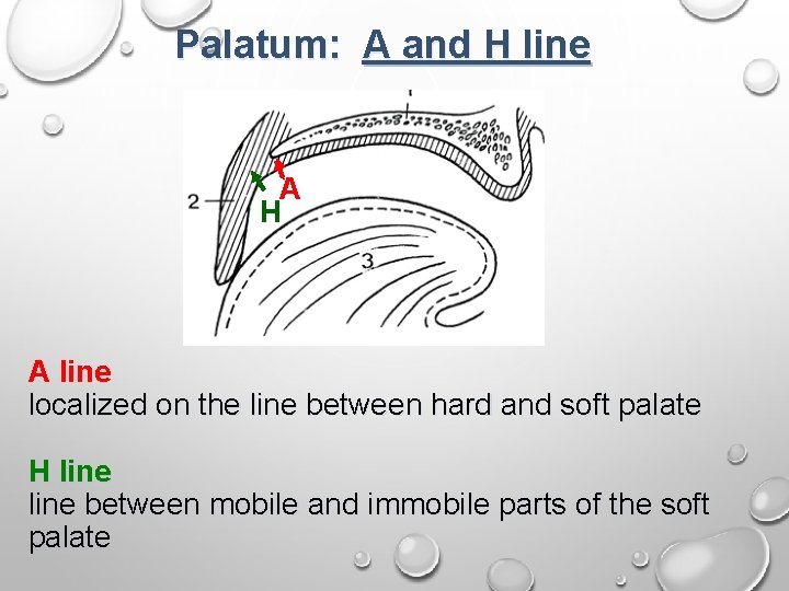 Palatum: A and H line A H A line localized on the line between