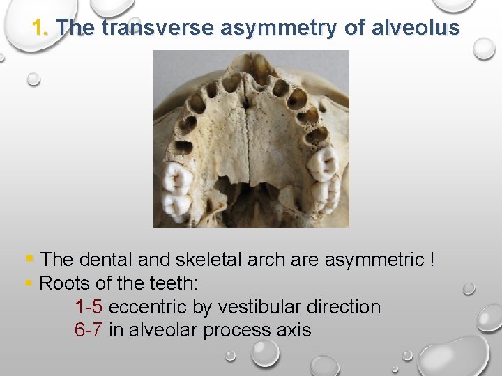 1. The transverse asymmetry of alveolus § The dental and skeletal arch are asymmetric