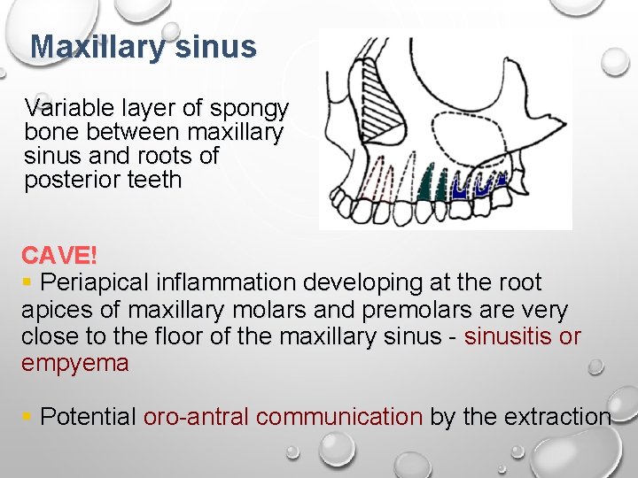 Maxillary sinus Variable layer of spongy bone between maxillary sinus and roots of posterior