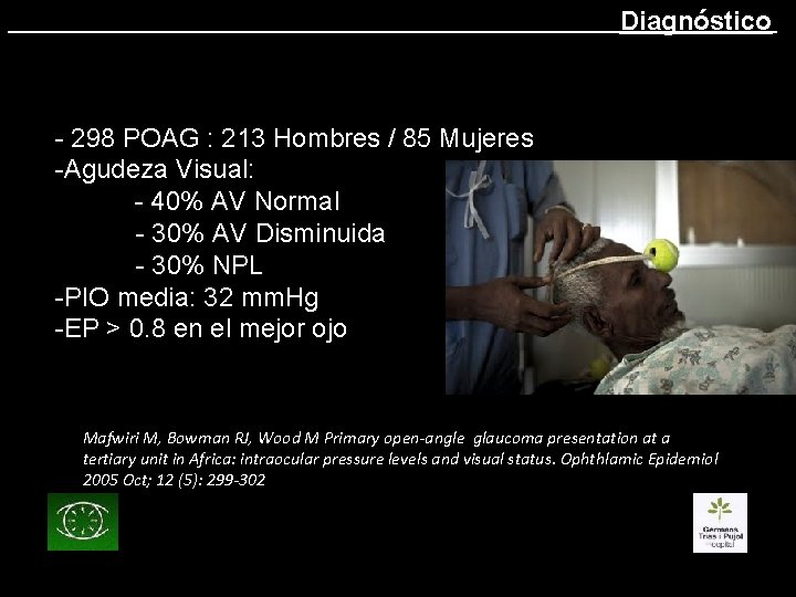 Diagnóstico - 298 POAG : 213 Hombres / 85 Mujeres -Agudeza Visual: - 40%