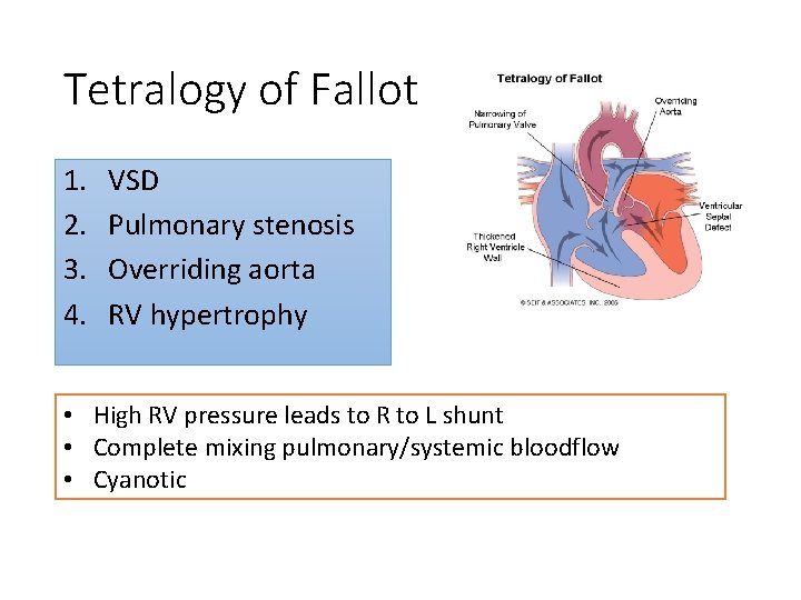 Tetralogy of Fallot 1. 2. 3. 4. VSD Pulmonary stenosis Overriding aorta RV hypertrophy