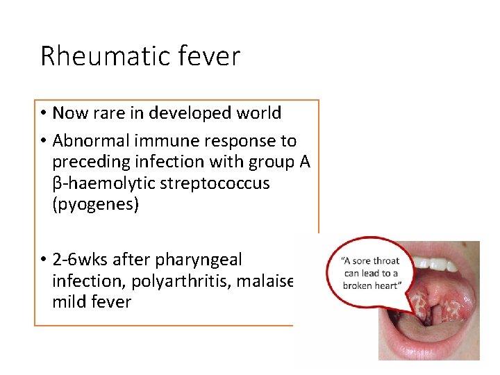 Rheumatic fever • Now rare in developed world • Abnormal immune response to preceding