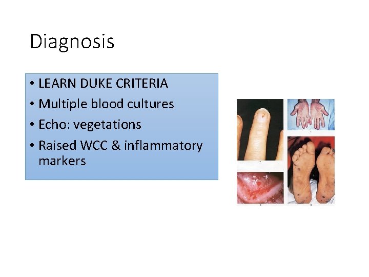 Diagnosis • LEARN DUKE CRITERIA • Multiple blood cultures • Echo: vegetations • Raised