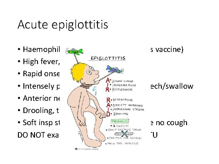Acute epiglottitis • Haemophilus influenza B (now rare as vaccine) • High fever, very