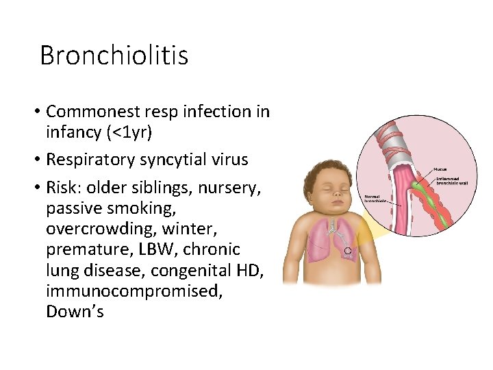 Bronchiolitis • Commonest resp infection in infancy (<1 yr) • Respiratory syncytial virus •