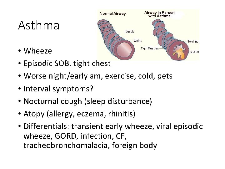 Asthma • Wheeze • Episodic SOB, tight chest • Worse night/early am, exercise, cold,