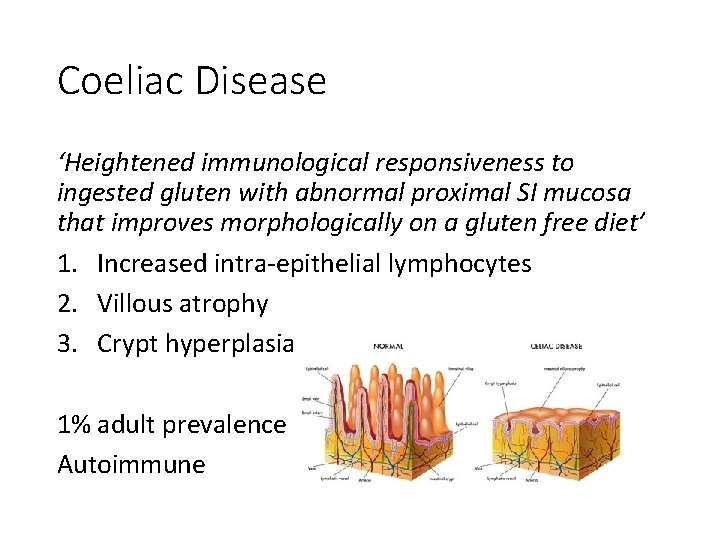 Coeliac Disease ‘Heightened immunological responsiveness to ingested gluten with abnormal proximal SI mucosa that