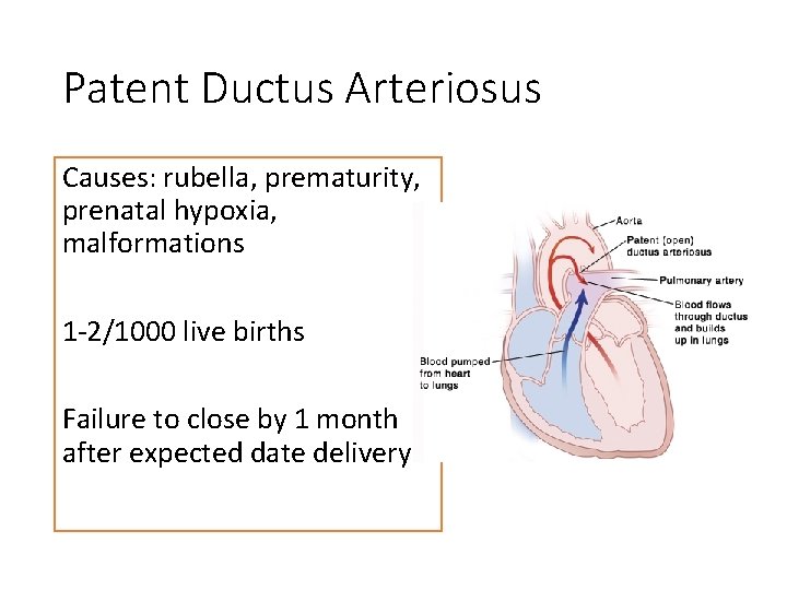 Patent Ductus Arteriosus Causes: rubella, prematurity, prenatal hypoxia, malformations 1 -2/1000 live births Failure
