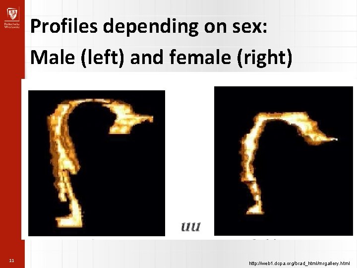 Profiles depending on sex: Male (left) and female (right) 11 http: //web 1. dcpa.