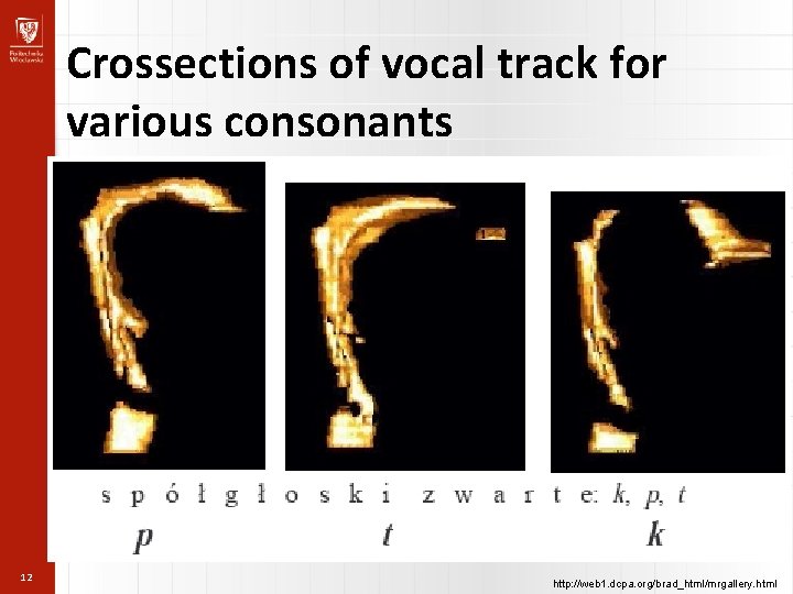 Crossections of vocal track for various consonants 12 http: //web 1. dcpa. org/brad_html/mrgallery. html