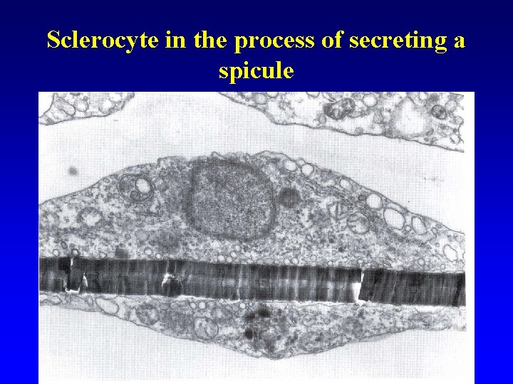 Sclerocyte in the process of secreting a spicule 