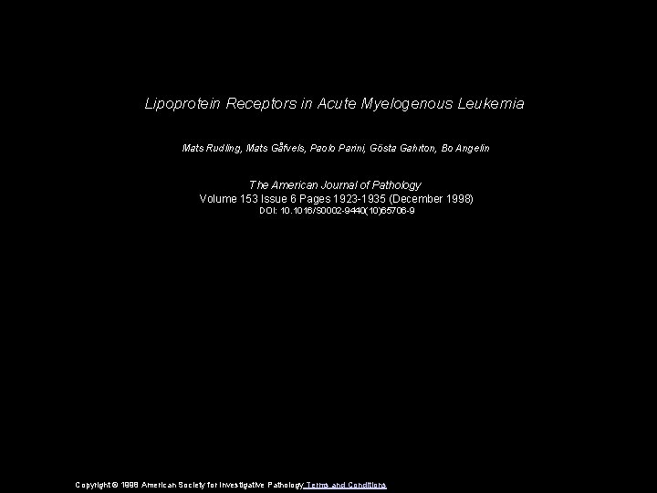 Lipoprotein Receptors in Acute Myelogenous Leukemia Mats Rudling, Mats Gåfvels, Paolo Parini, Gösta Gahrton, Lipoprotein Receptors in Acute Myelogenous Leukemia Mats Rudling, Mats Gåfvels, Paolo Parini, Gösta Gahrton,