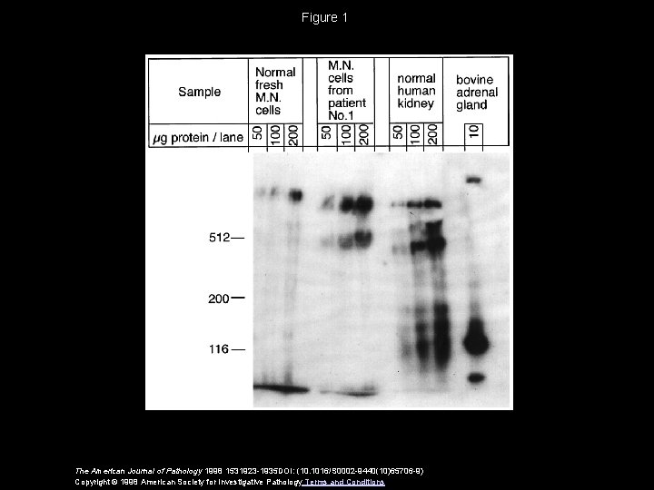 Figure 1 The American Journal of Pathology 1998 1531923 -1935 DOI: (10. 1016/S 0002 Figure 1 The American Journal of Pathology 1998 1531923 -1935 DOI: (10. 1016/S 0002