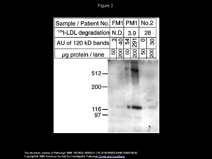 Figure 2 The American Journal of Pathology 1998 1531923 -1935 DOI: (10. 1016/S 0002 Figure 2 The American Journal of Pathology 1998 1531923 -1935 DOI: (10. 1016/S 0002
