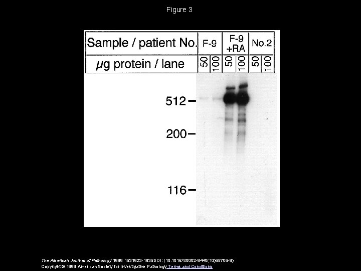 Figure 3 The American Journal of Pathology 1998 1531923 -1935 DOI: (10. 1016/S 0002 Figure 3 The American Journal of Pathology 1998 1531923 -1935 DOI: (10. 1016/S 0002