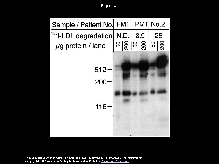 Figure 4 The American Journal of Pathology 1998 1531923 -1935 DOI: (10. 1016/S 0002 Figure 4 The American Journal of Pathology 1998 1531923 -1935 DOI: (10. 1016/S 0002