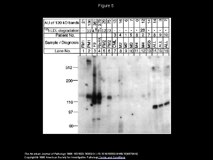 Figure 5 The American Journal of Pathology 1998 1531923 -1935 DOI: (10. 1016/S 0002 Figure 5 The American Journal of Pathology 1998 1531923 -1935 DOI: (10. 1016/S 0002