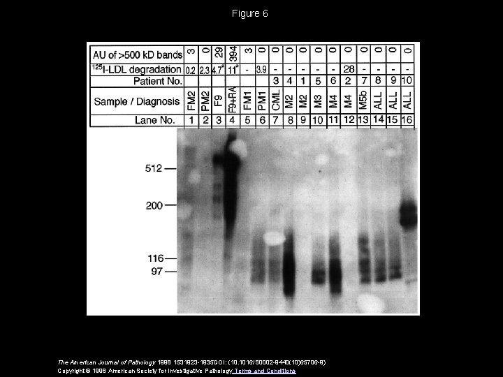 Figure 6 The American Journal of Pathology 1998 1531923 -1935 DOI: (10. 1016/S 0002 Figure 6 The American Journal of Pathology 1998 1531923 -1935 DOI: (10. 1016/S 0002