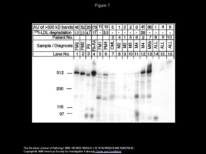 Figure 7 The American Journal of Pathology 1998 1531923 -1935 DOI: (10. 1016/S 0002 Figure 7 The American Journal of Pathology 1998 1531923 -1935 DOI: (10. 1016/S 0002