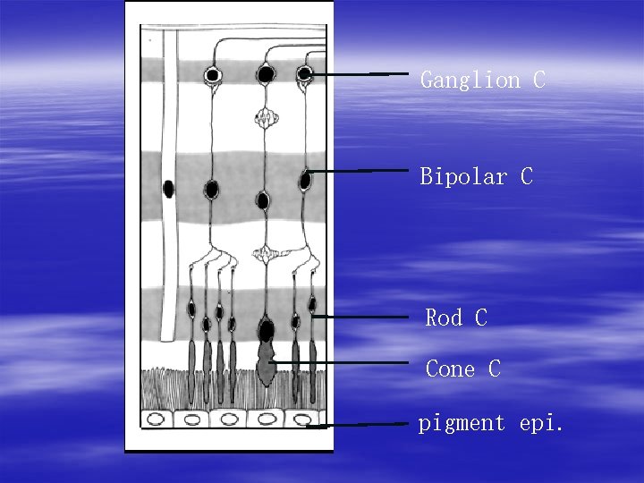 Ganglion C Bipolar C Rod C Cone C pigment epi. 