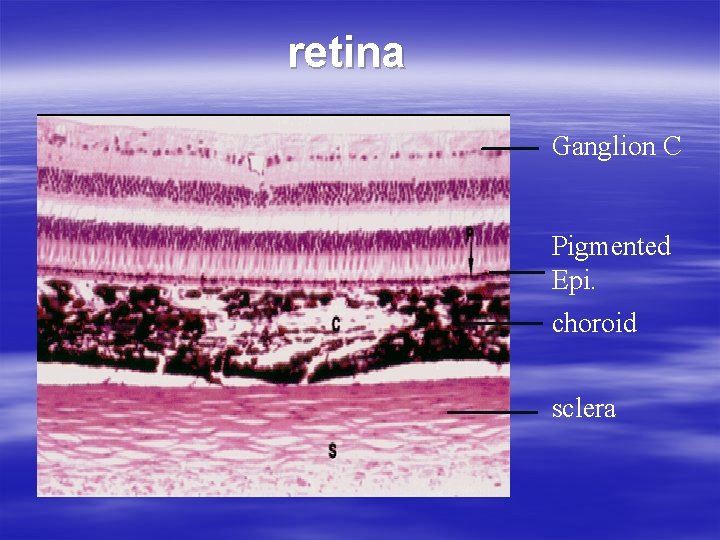 retina Ganglion C Pigmented Epi. choroid sclera 