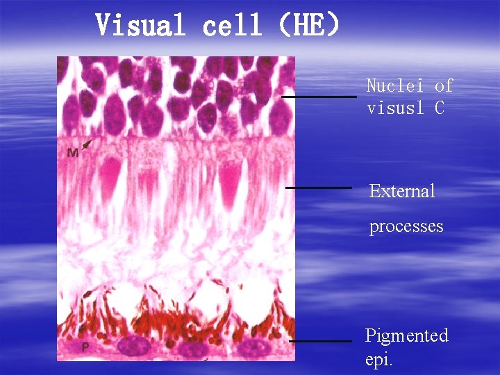 Visual cell（HE） Nuclei of visusl C External processes Pigmented epi. 