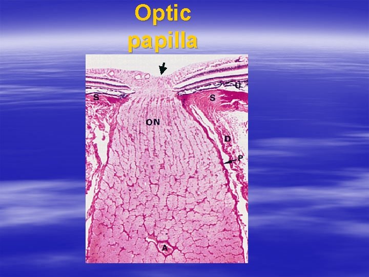 Optic papilla 