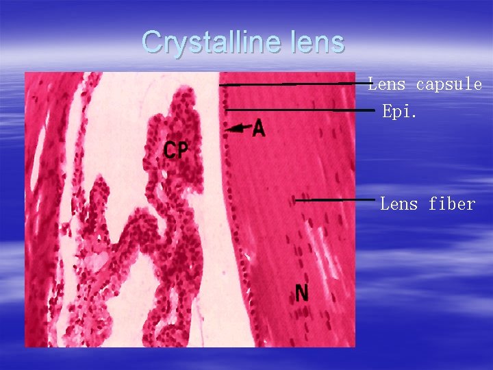 Crystalline lens Lens capsule Epi. Lens fiber 