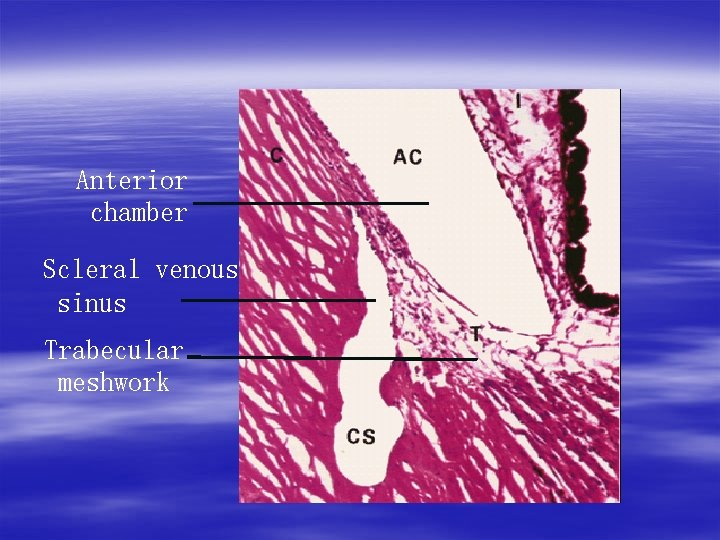 Anterior chamber Scleral venous sinus Trabecular meshwork 