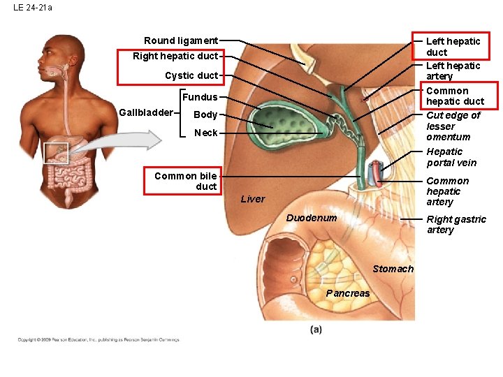 LE 24 -21 a Round ligament Left hepatic duct Left hepatic artery Common hepatic LE 24 -21 a Round ligament Left hepatic duct Left hepatic artery Common hepatic