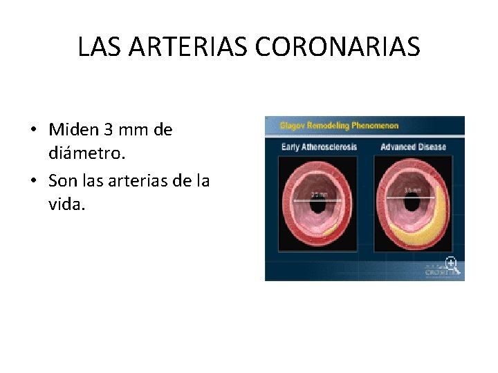 LAS ARTERIAS CORONARIAS • Miden 3 mm de diámetro. • Son las arterias de