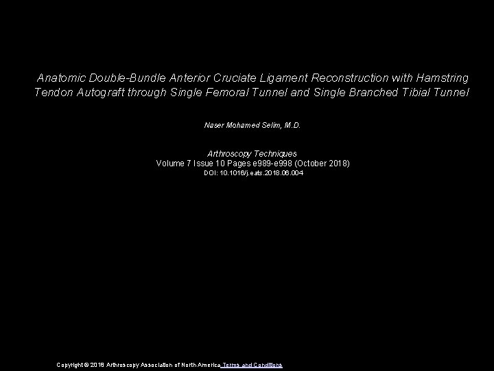 Anatomic Double-Bundle Anterior Cruciate Ligament Reconstruction with Hamstring Tendon Autograft through Single Femoral Tunnel