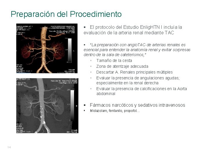 Preparación del Procedimiento § El protocolo del Estudio Enlig. HTN I incluía la evaluación