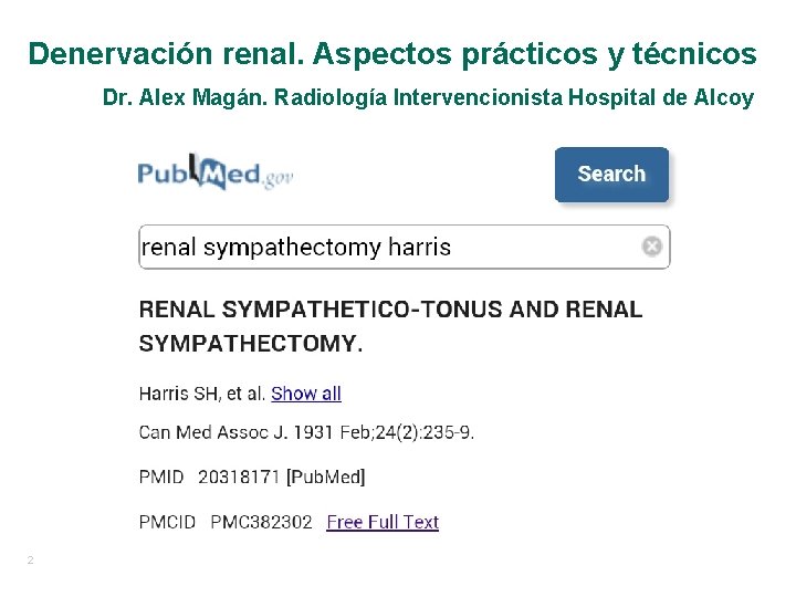 Denervación renal. Aspectos prácticos y técnicos Dr. Alex Magán. Radiología Intervencionista Hospital de Alcoy