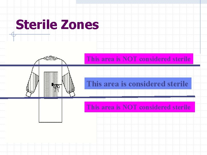 Sterile Zones This area is NOT considered sterile 