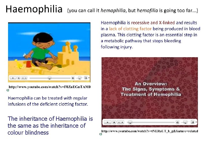 The inheritance of Haemophilia is the same as the inheritance of colour blindness 