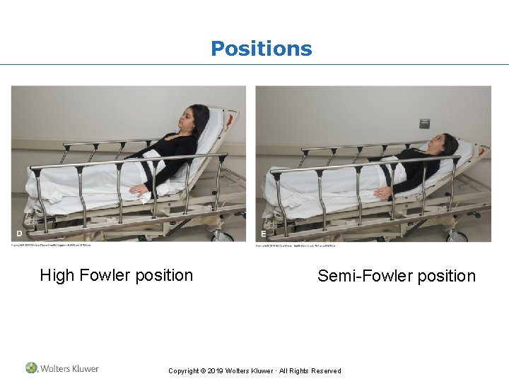 Positions High Fowler position Semi-Fowler position Copyright © 2019 Wolters Kluwer · All Rights