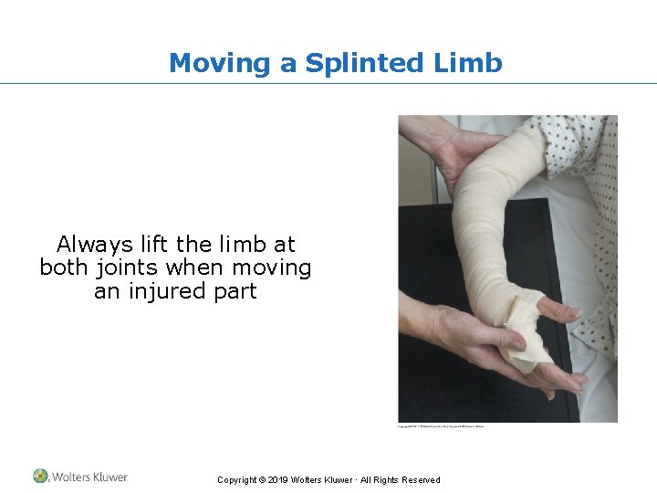 Moving a Splinted Limb Always lift the limb at both joints when moving an
