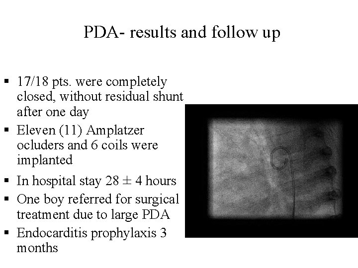 PDA- results and follow up § 17/18 pts. were completely closed, without residual shunt