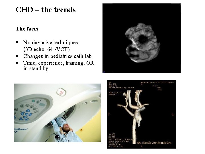CHD – the trends The facts § Noninvasive techniques (3 D echo, 64 -VCT)