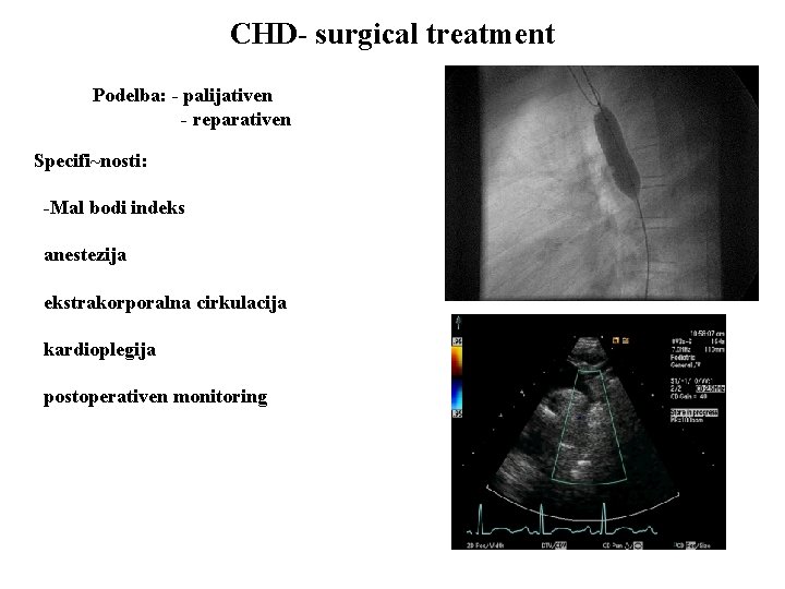 CHD- surgical treatment Podelba: - palijativen - reparativen Specifi~nosti: -Mal bodi indeks anestezija ekstrakorporalna