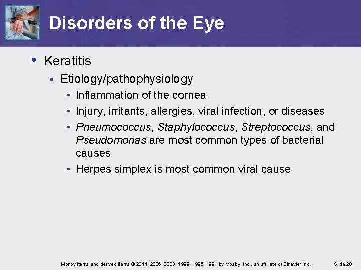 Disorders of the Eye • Keratitis § Etiology/pathophysiology • Inflammation of the cornea •