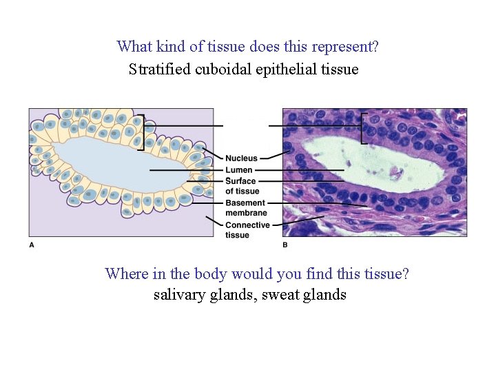What kind of tissue does this represent? Stratified cuboidal epithelial tissue Where in the