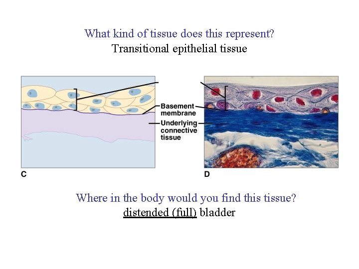 What kind of tissue does this represent? Transitional epithelial tissue Where in the body