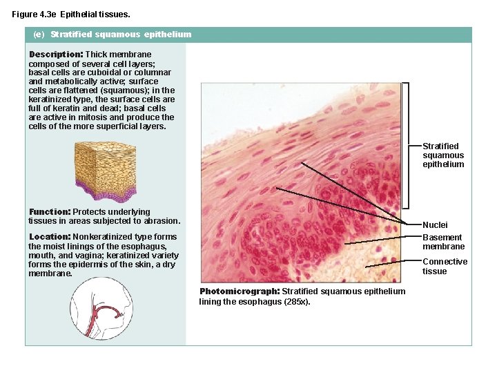 Figure 4. 3 e Epithelial tissues. (e) Stratified squamous epithelium Description: Thick membrane composed