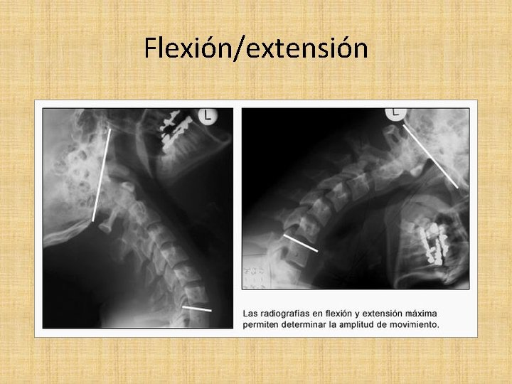 Flexión/extensión 