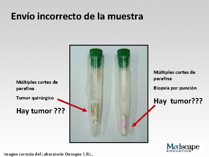 Envío incorrecto de la muestra Múltiples cortes de parafina Tumor quirúrgico Hay tumor ?