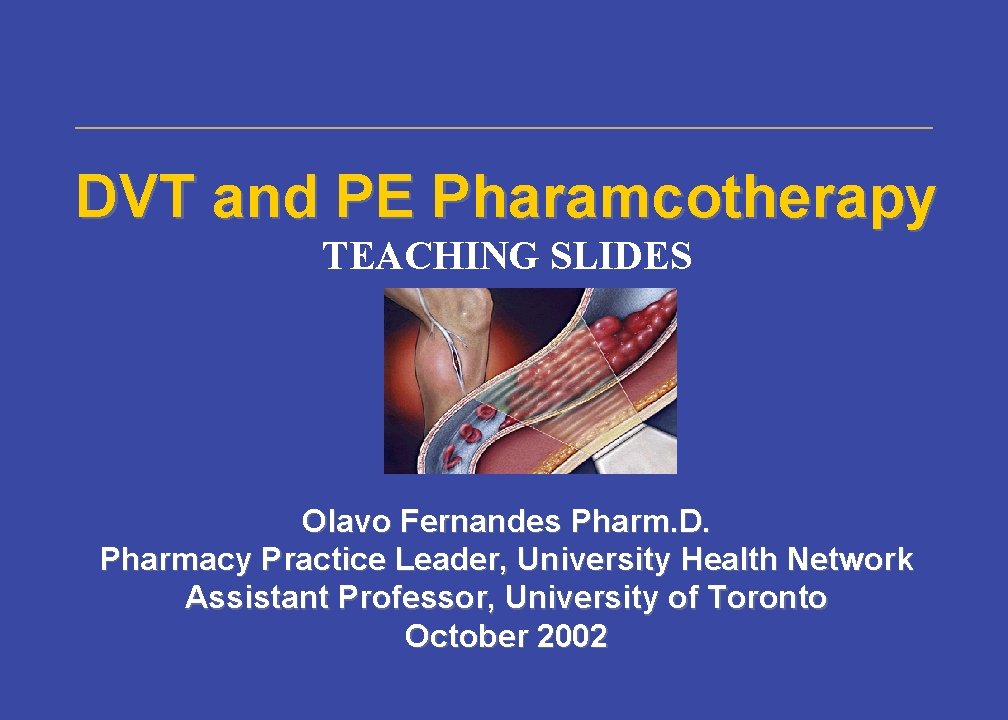 DVT and PE Pharamcotherapy TEACHING SLIDES Olavo Fernandes Pharm. D. Pharmacy Practice Leader, University DVT and PE Pharamcotherapy TEACHING SLIDES Olavo Fernandes Pharm. D. Pharmacy Practice Leader, University