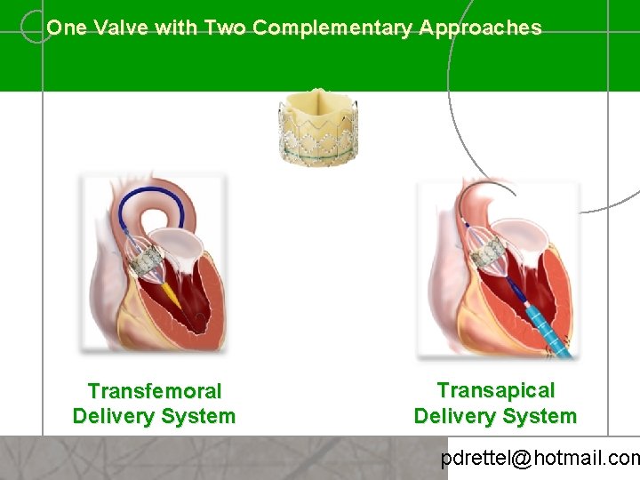 One Valve with Two Complementary Approaches Transfemoral Delivery System Transapical Delivery System pdrettel@hotmail. com