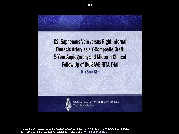 Video 1 The Journal of Thoracic and Cardiovascular Surgery 2018 1561424 -1433. e 1